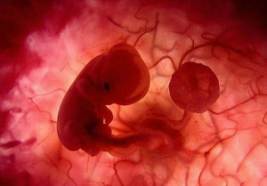baby-born-04